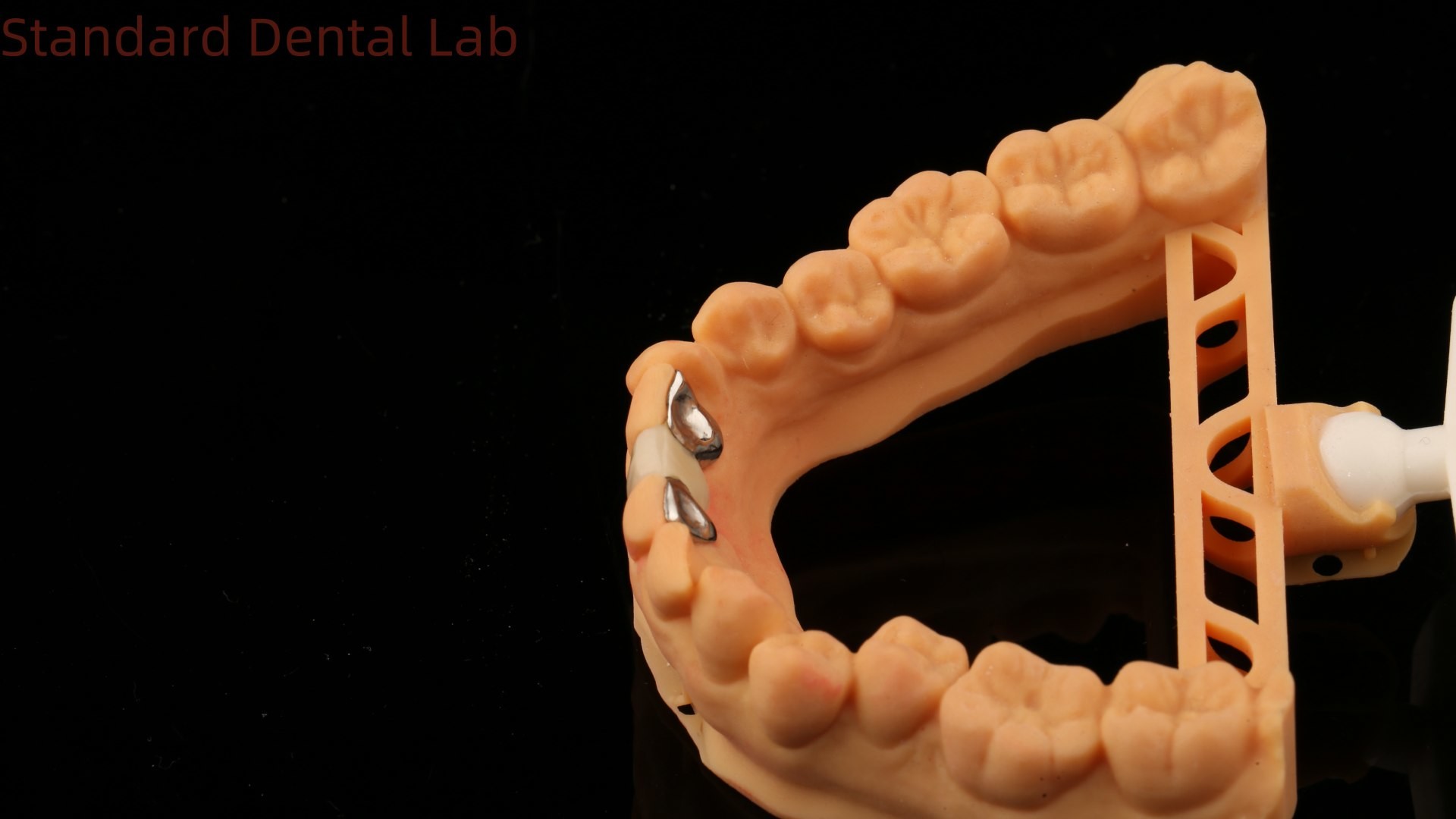 Dental PFM Maryland Bridge High Esthetics FDA Certified With Vita Porcelian China Dental Lab