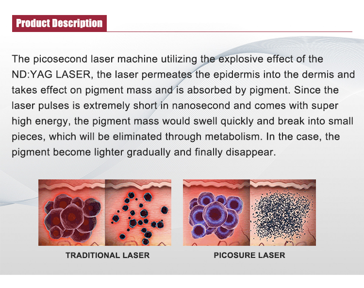 Portable Pico Second Laser Tatoo Remover Q Switched Nd Yag Picosecond Tattoo Removal Machine