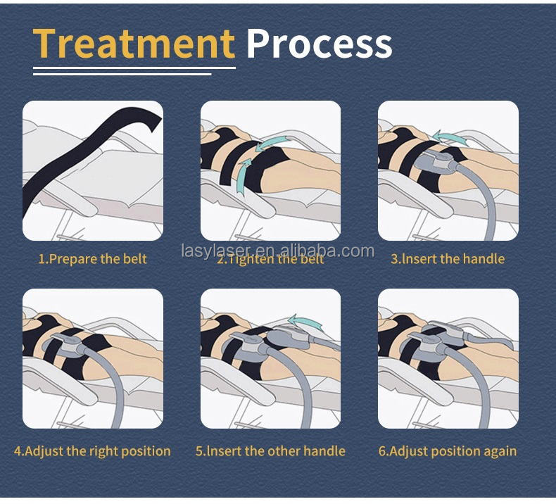 High Intense4 Handle Emslim Nova Machine Electromagnetic Ems Therapy Machine