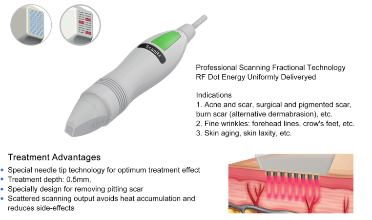Scan Scar RF Acne Treatment Machine Ultraviolet Rays Micro Needle