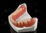 High Esthetics Removable Full Acrylic Denture Acrylic Complete Denture