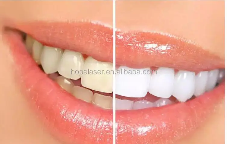 TOOTH .2.jpg