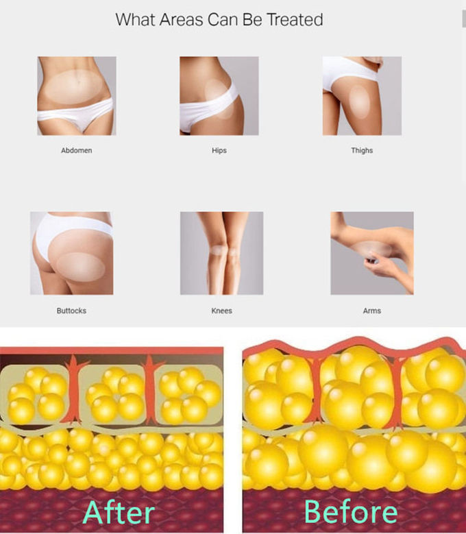 Home Use 5Hz Acoustic Shockwave ESWT Therapy Machine With Specially Designed Tips For Erectile Disfunction