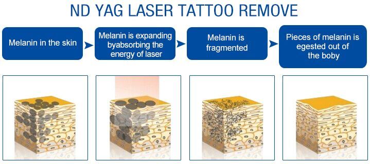 220V Picosecond Laser Tattoo Removal Machine For Cleaning Skin Rejuvenation
