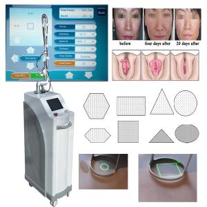 China 2015 innovative product fractional co2 laser machine CO2 laser english wholesale