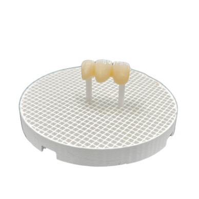 White Fix Firing Paste For Stabilizing Ceramic Restorations