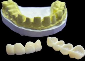 China Stain Resistant Dental Porcelain Crowns and Bridges in Vita Classical Shades for Natural Aesthetics wholesale