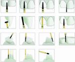 Dental Rotary Instrument Dental Handpiece Burs Diamond Grinding Burs