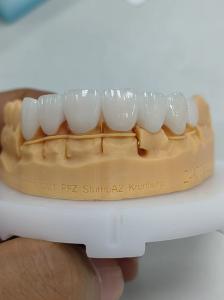 China 5mm-6mm Layered Zirconia Crowns Strength Zirconia Multilayer Crown wholesale