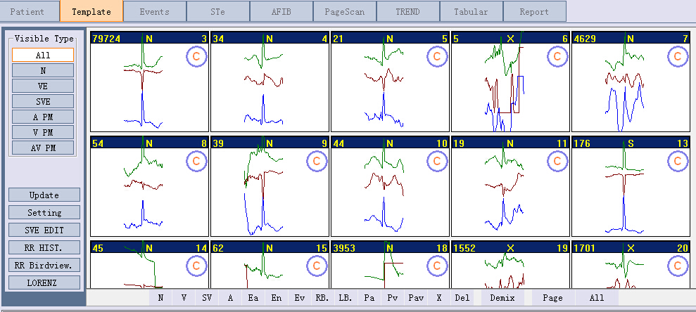 Portable ECG Machine Mini grabadora digital holter de ECG de 3 canales de 3 días con Detección de marcapasos