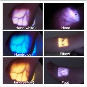 China Projection Infrared Medical Vein Finder Detector , Higher Accuracy Venipuncture wholesale