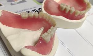 China Hot Cured Removable Aesthetic Lower Partial Acrylic Denture wholesale