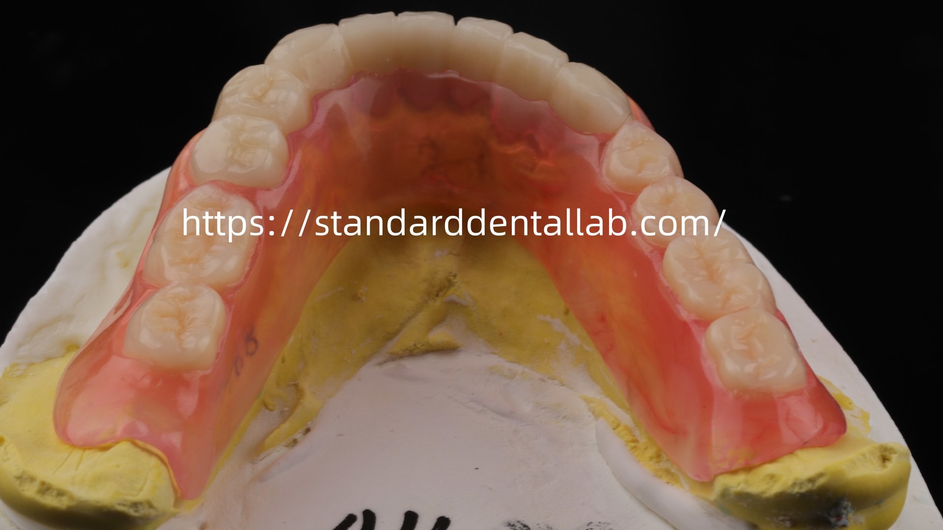 High Esthetics Dental TCS Valplast Flexible Partial Dentures Dental Lab Valplast Clasp Pink Shade