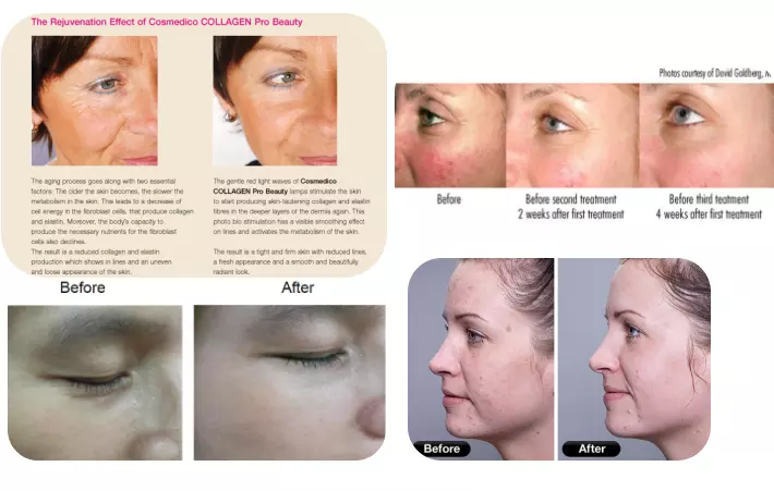 Anti Aging LED Red Light Therapy Beds