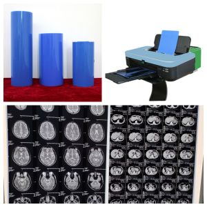 China White Opaque Inkjet Medical Film With Glossy Surface Finish 11x14 wholesale