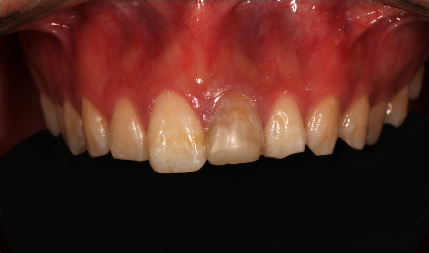 1100Mpa Pre Sintered Zirconium Oxide Ceramic