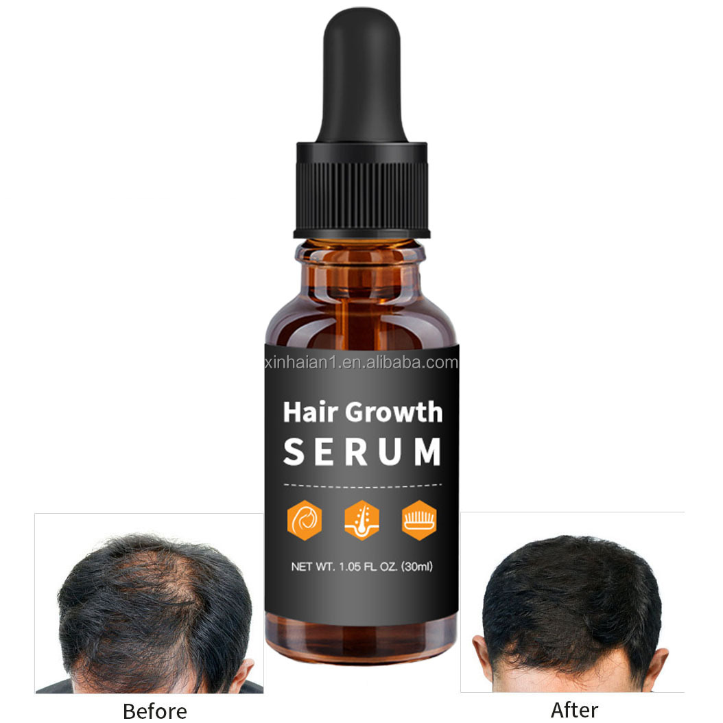 Customization Hair Growth Treatment Serum for Black Women Private Label