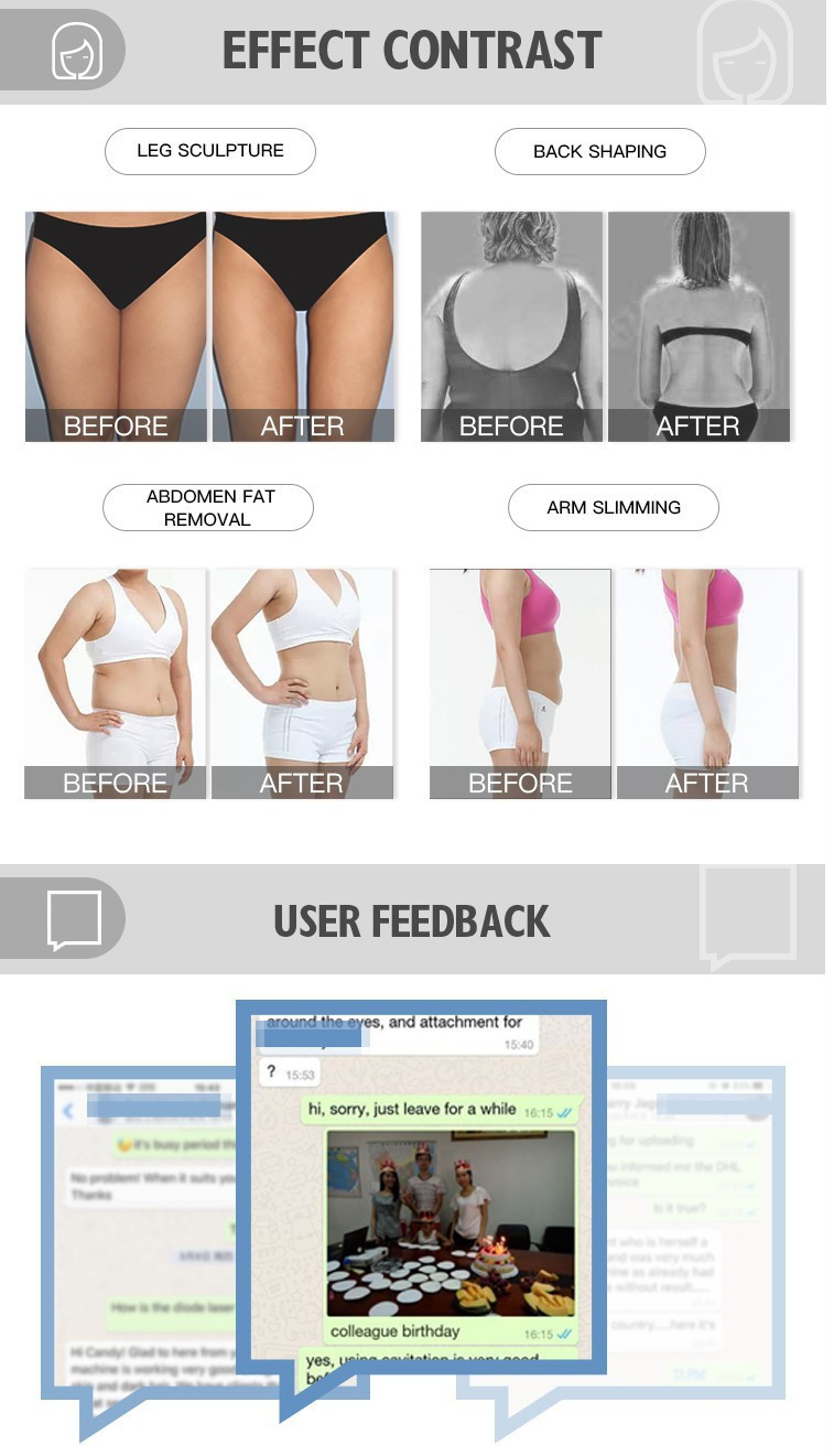 180 Degree 40K Cavitation Ultrasound RF bodyshape Slimming Machine