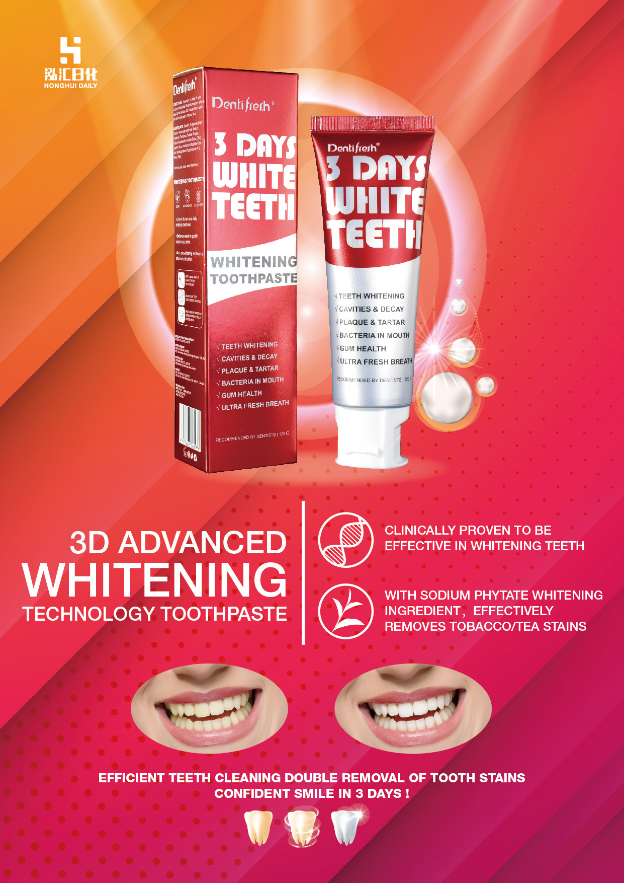 Dentifresh Teeth Whitening Toothpastes Non Irritating 130g