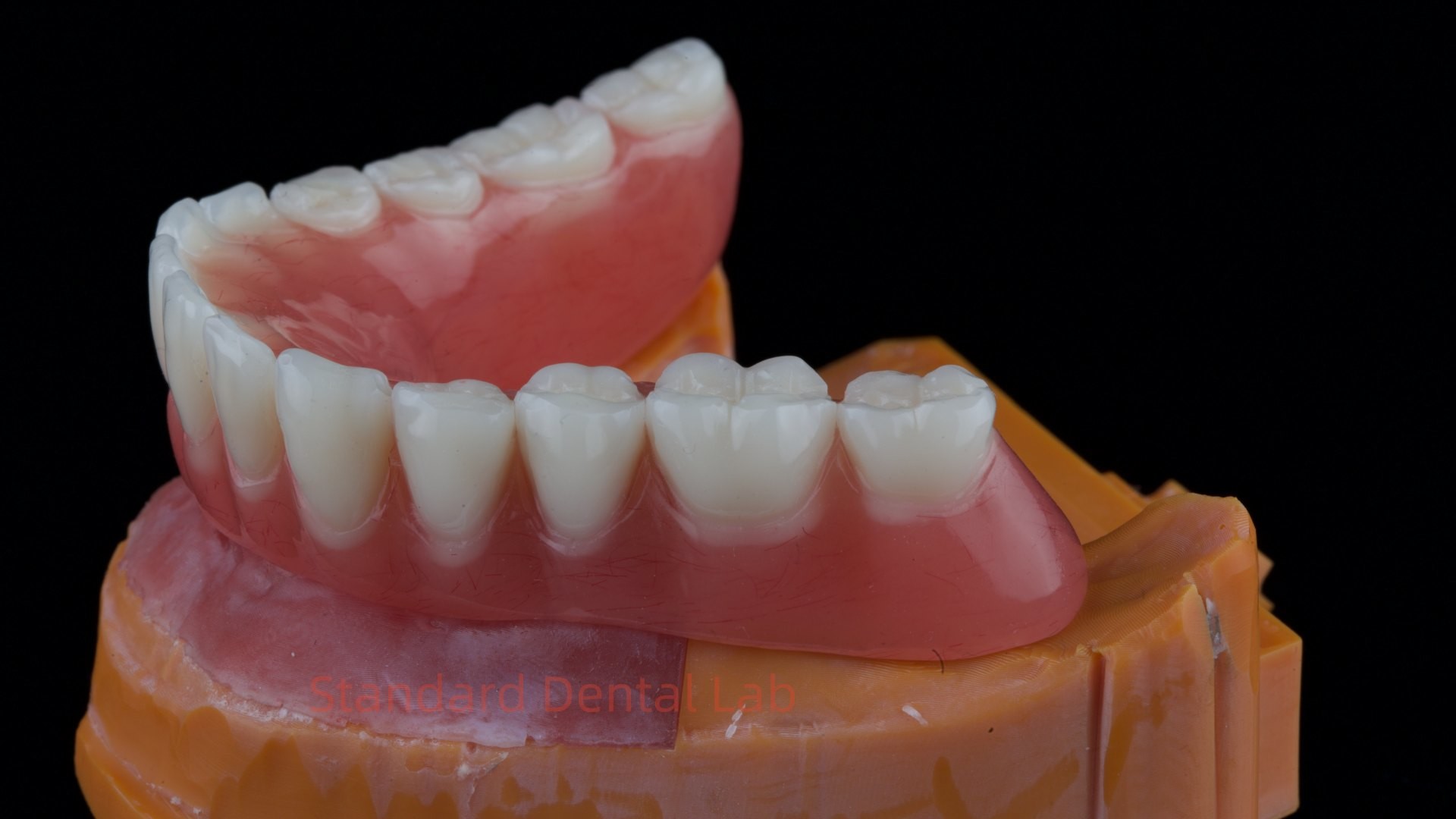 Ivoclar Digital Dental Implant Bar Denture with Attachments Full Acrylic Denture Titanium Implant Supported Dentures