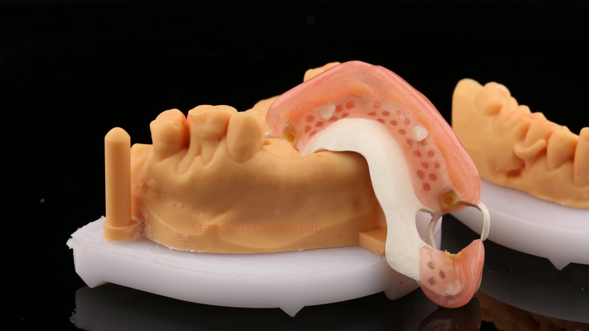 Peek Partial Framework Design ISO CE And FDA Dental Lab Acrylic Partial Denture Framework