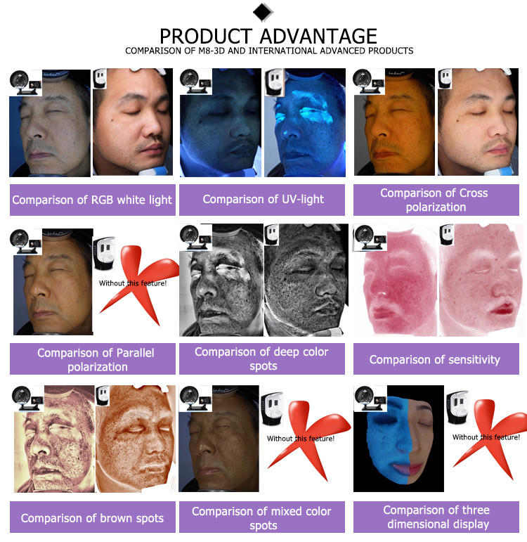 New acial quartus nls 3d gold detecto beauty machine test 3d portable facial skin scanner analyzer of moisture