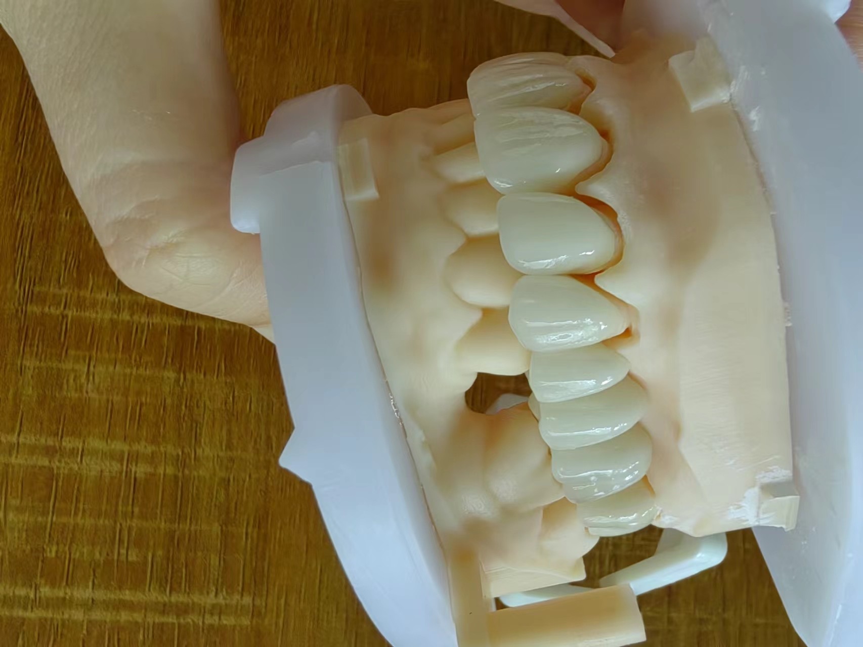 Aesthetic Zirconia Dental Restorations Zirconia Porcelain Crowns