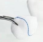 China Medical Gauze Balls 100% Bleached Cotton 100 Pcs/Pack ce certification wholesale