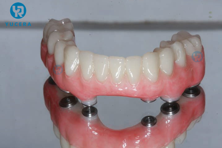 10mm - 25mm Dental PMMA Blocks Denture Restoration Multilayer PMMA Disc