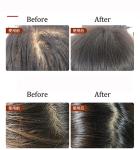 All Hair Types Anti-hair Loss Organic Hair Care Set with Ginger Shampoo and