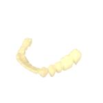 Luxurious Aesthetics Temporary Crown Resin Superior Strength