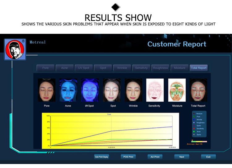 a-one tab 3d nls Digital Skin Analyzer beauty machine system portable UV analyzer Skin with the test of moisture