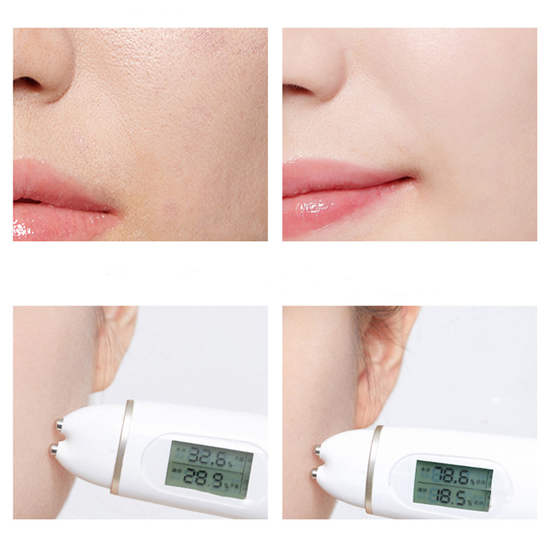 bioaqua essence acne serum