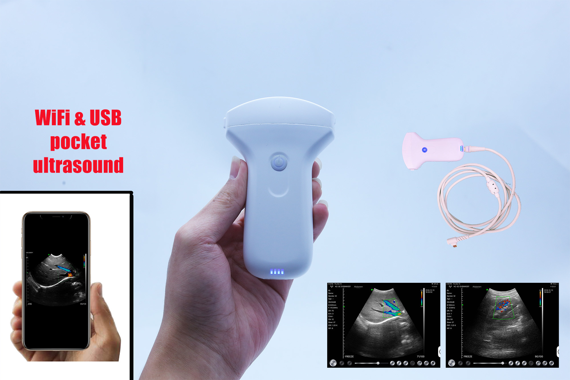 Wifi Portable Ultrasound Scanner Wireless Ultrasound Linear Probe, 7-10Mhz 128 elements