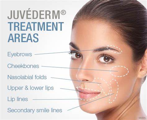 Injectable Gel Juvederm Dermal Filler On Face Room Temperature Storage