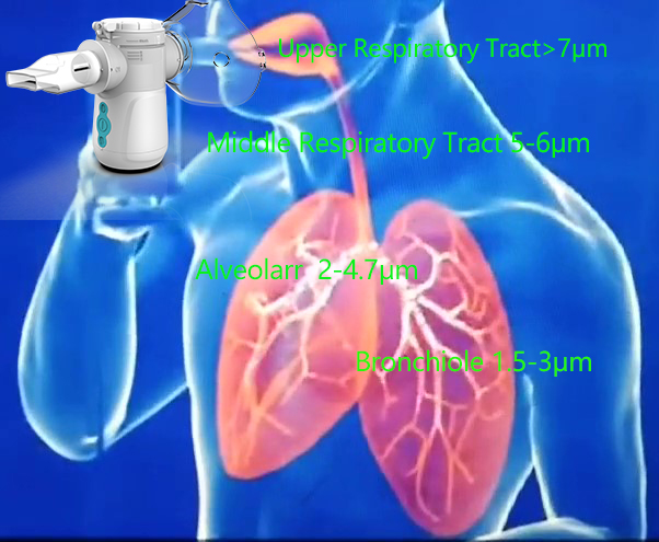 Pediatric Mesh Nebulizer Inhaler Machine System 82% MMAD 2.0-3.1μm Chest Diseases