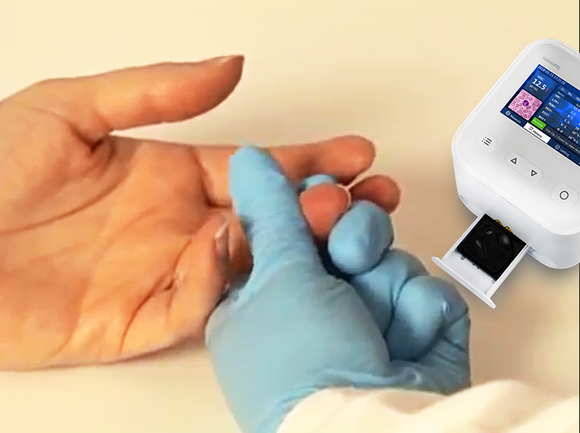 POCT device (WBC-6) Colorful screen hematology WBC Analyzer with microfluidics chips