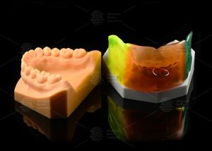 China Adjustable Medical Silicone Vestibular Shield Breathable Orthodontic Functional Appliance wholesale