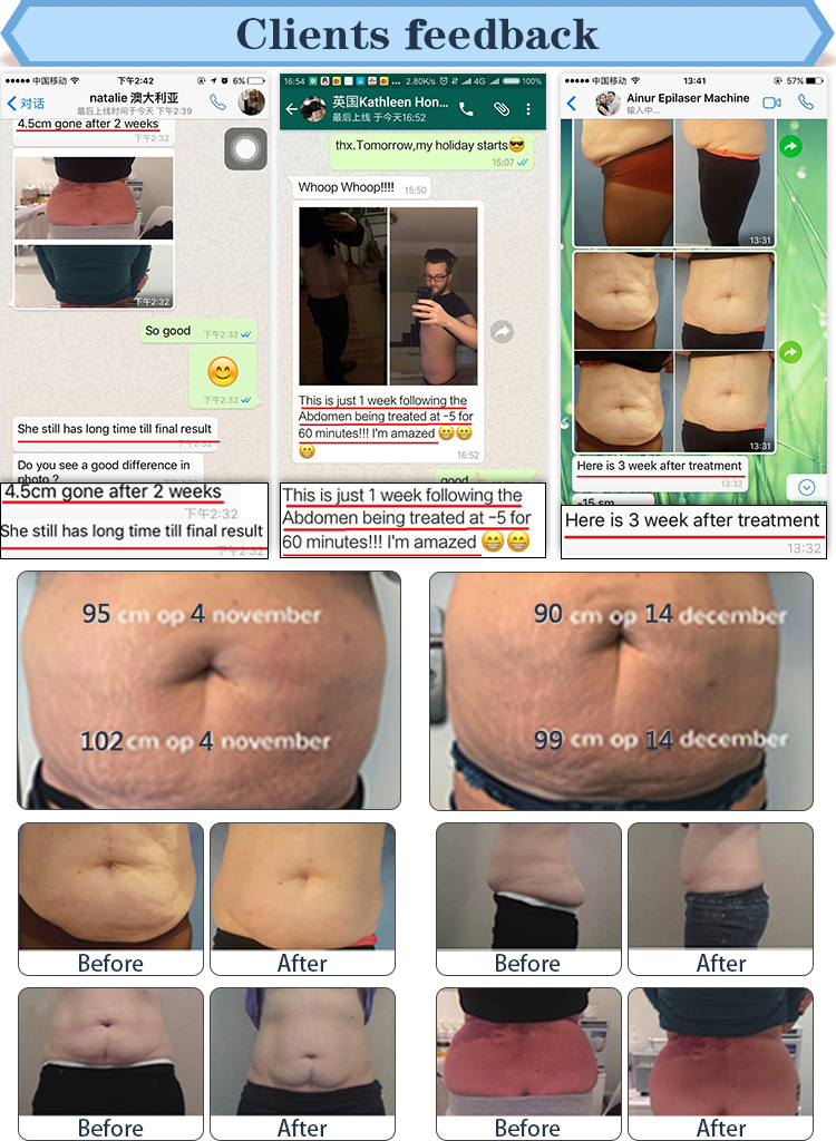 CE Approved High Quality Professional Body Shaping Antifreeze Weight Loss 4 Handles Cryolipolysis Machine