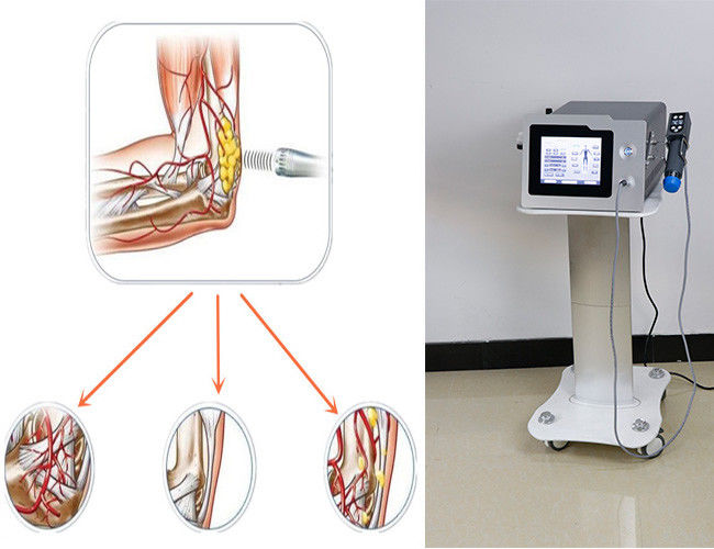 7 Tips Electromagnetic Pain Relief Shockwave Therapy Machine