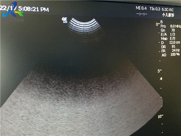 GE 6.5C RC Used Abdominal Ultrasound Probe Logiq C2 System