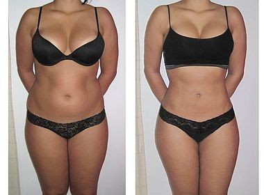 Face Lift RF Cavitation Slimming Machine 4 In 1 40KHz With Supersonic Operation System