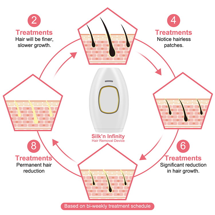 Dropshipping 2021 Ipl Laser Hair Removal