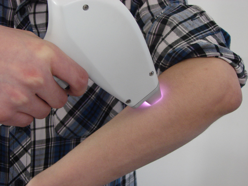 808 Diode Laser Portable Laser Hair Removal Machine for Dark Skin