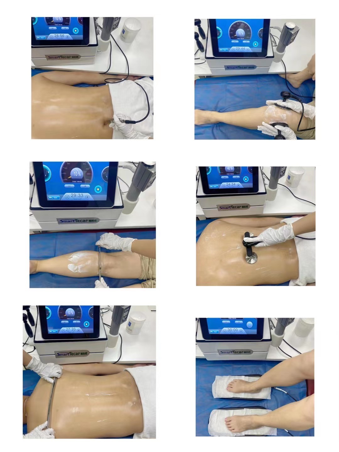 Ultrasound Therapy Tecar Shock Wave Diathermy Machine Radio Frequency 450KHZ