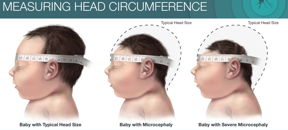 Customized Sturdy PP Plastic Head Mid Upper Arm Circumference Tape 60 Inches For Adults Measuring