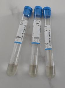 China Disposable Vacuum Blood Collection PRP Tube ACD+GEL Sterile Tube wholesale