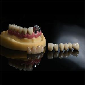 China Dentists Cad Cam PFM Crown Ceramic Material Metal Foundation wholesale