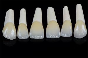 China Long Lasting Permanent White Dental Porcelain Veneers Stain Resistance wholesale