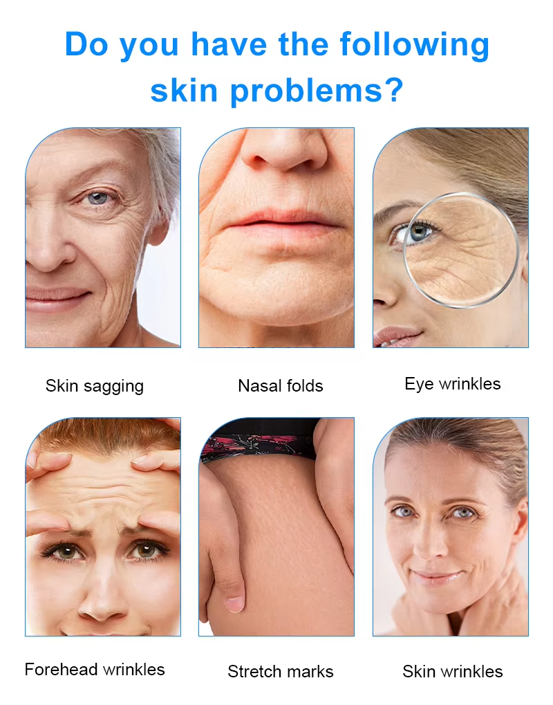 Skin Rejuvenation Wrinkle Removal Face Skin Lifting 12D Hifu Machine